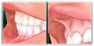 Lenoir City Laser Dentistry