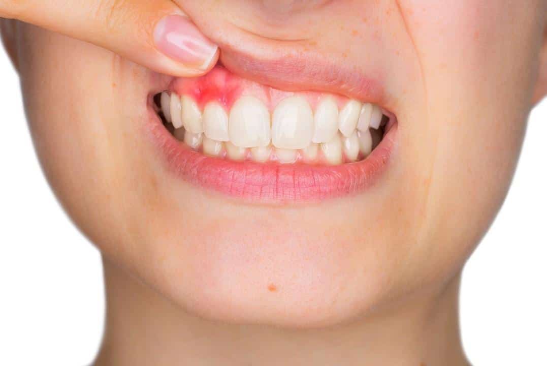 Lenoir City Laser Dentistry