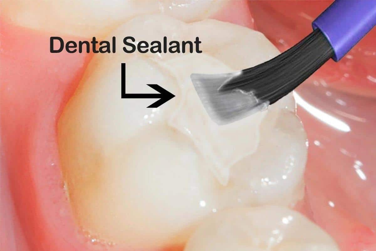 Lenoir City General/Restorative Dentistry