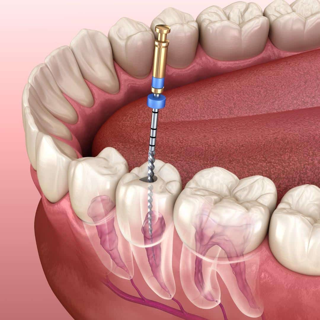 Lenoir City General/Restorative Dentistry
