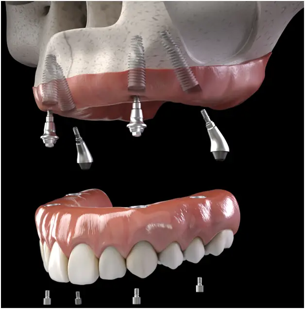 Lenoir City Dental Technology