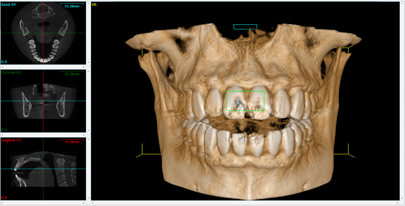 Lenoir City Dental Technology