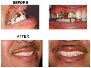 Lenoir City Cosmetic Dentistry