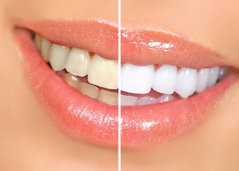 Lenoir City Cosmetic Dentistry