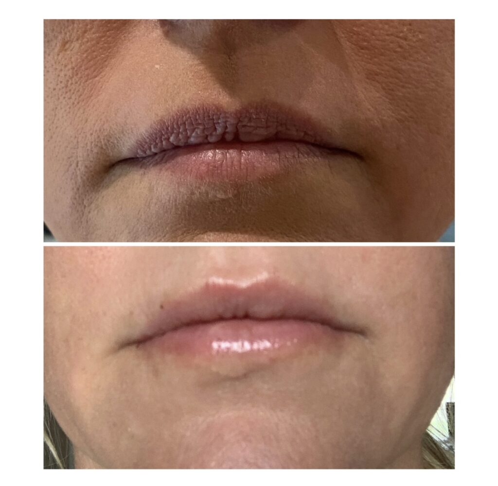 Lenoir City Esthetics