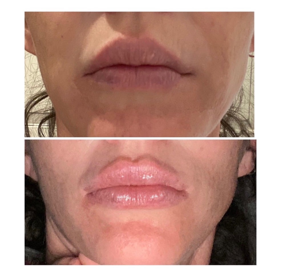 Lenoir City Esthetics