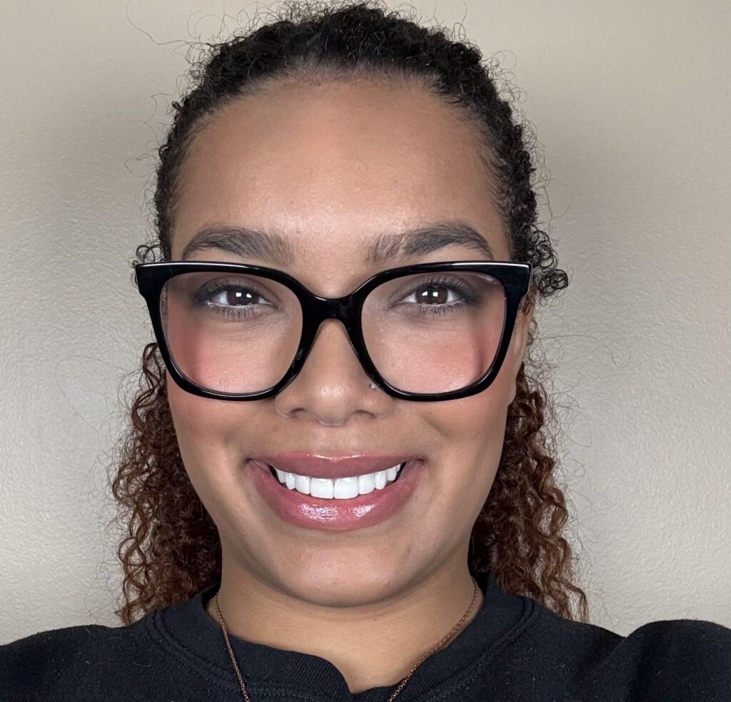 After Image: Veneers - front