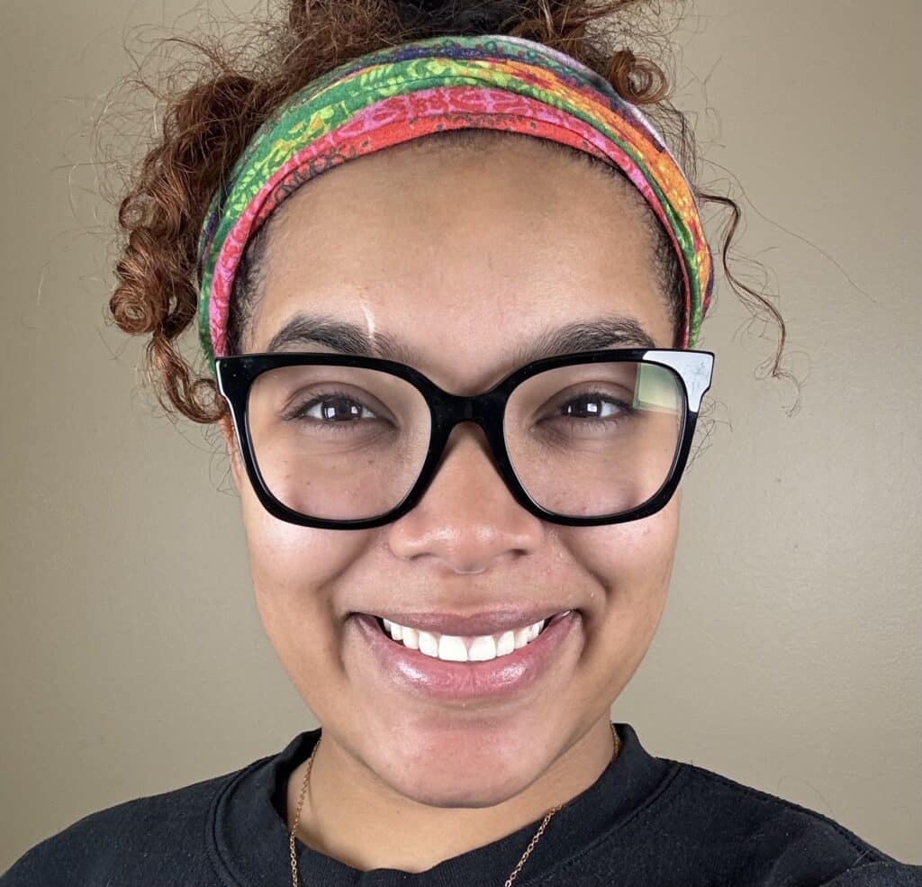 Before Image: Veneers - front